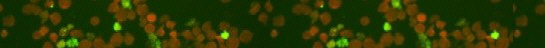 a_Ehrlichia_1